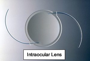 IOL