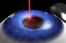 eye