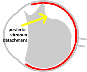 pvd image 2